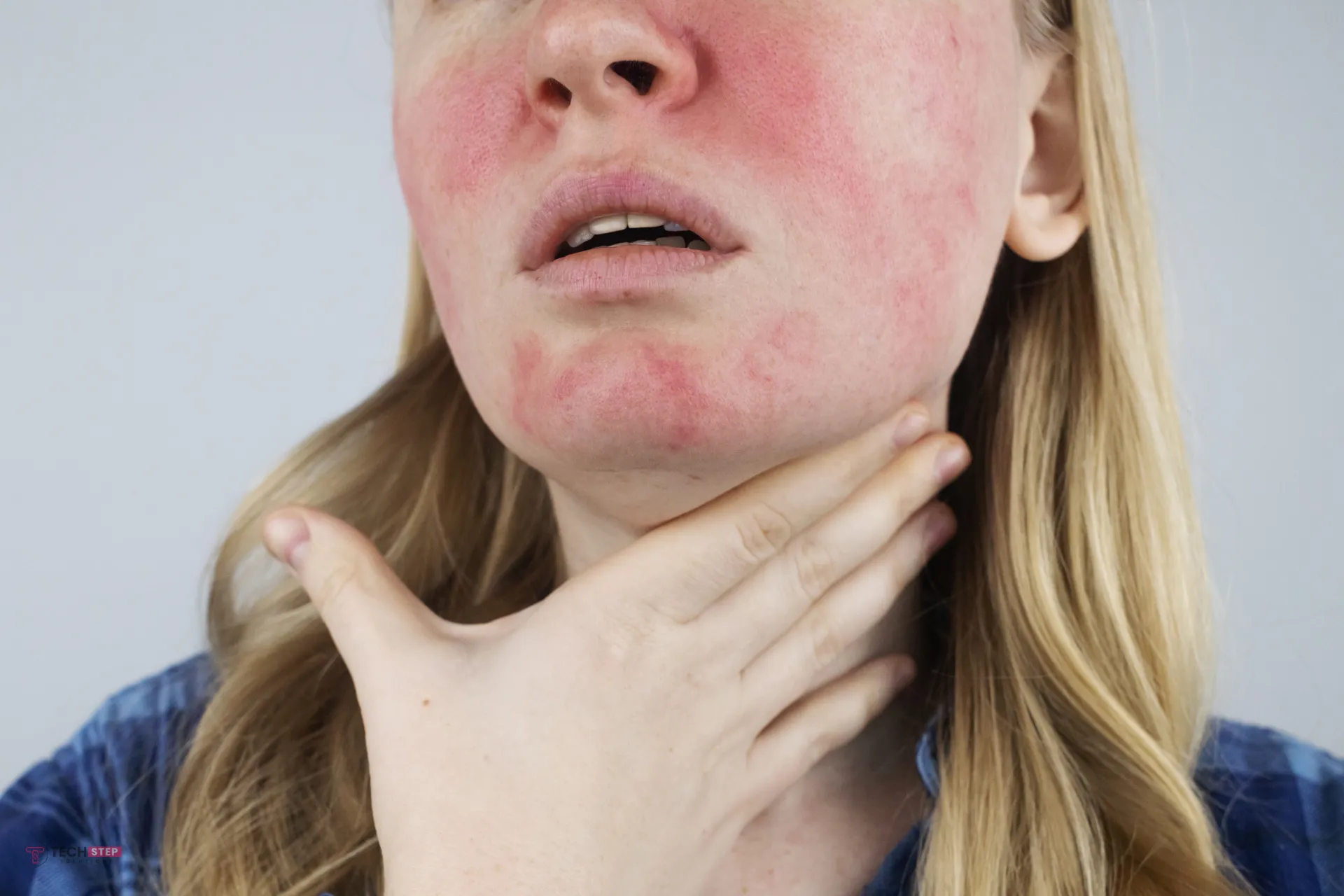 How to Get Rid of Rosacea Permanently | Calm Sensitive Skin How to Get Rid of Rosacea Permanently | Calm Sensitive Skin