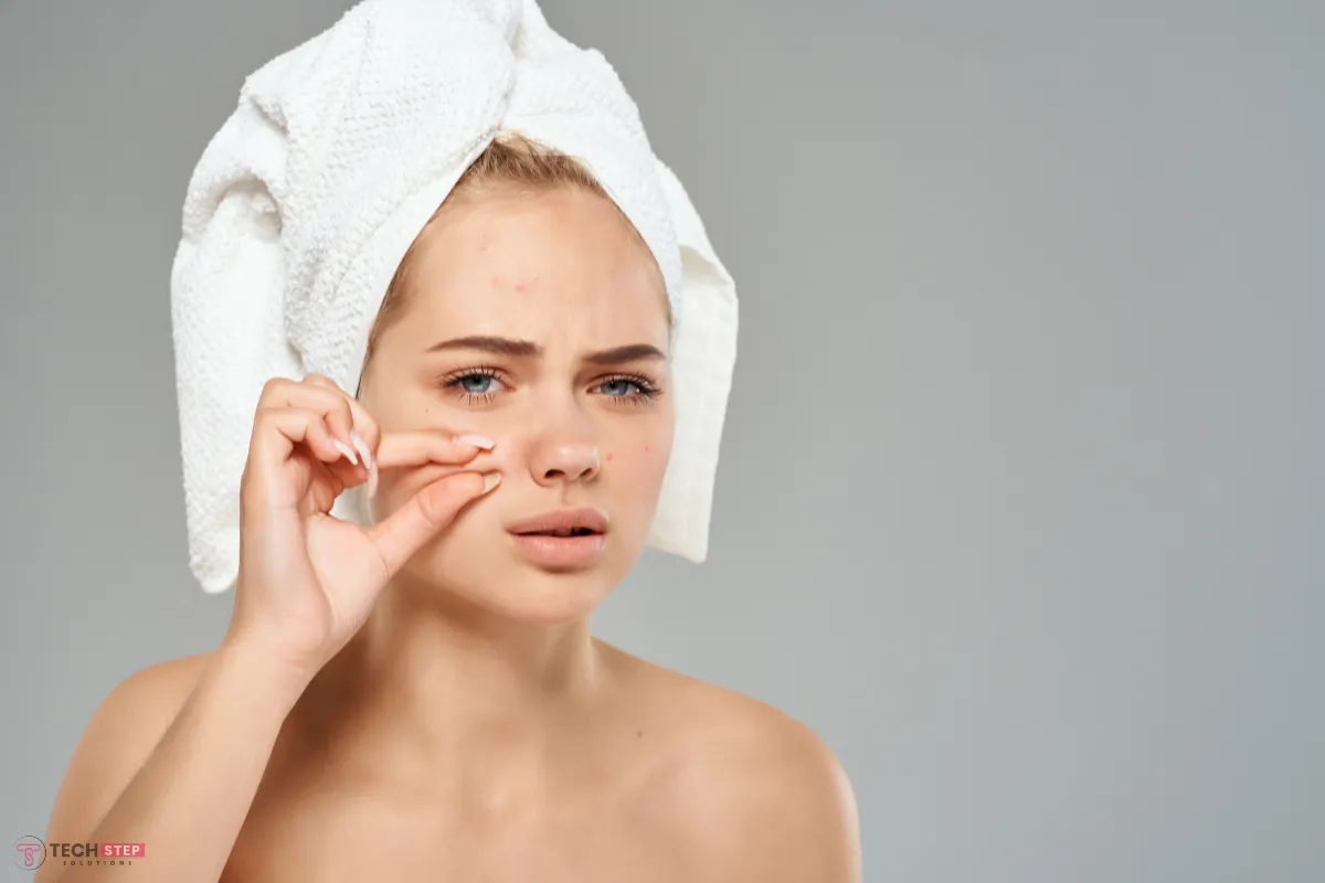 Woman examining acne on her face — acne treatment at Yana Skin Care Houston