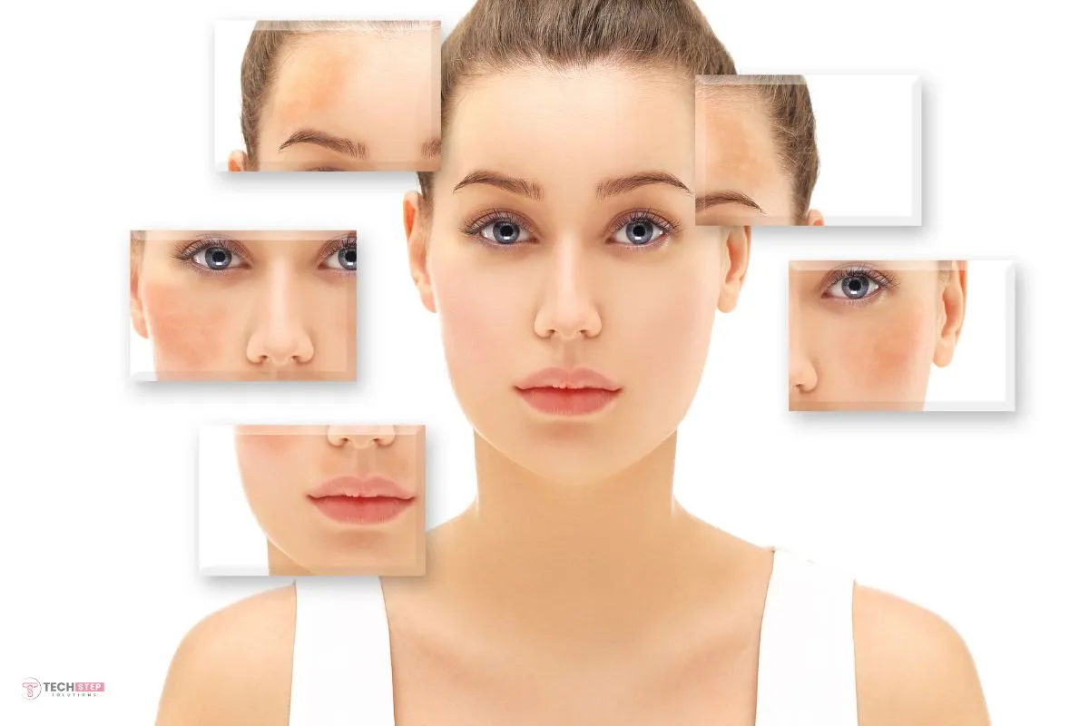 Melasma Explained Causes of Dark Patches & Uneven Skin Tone