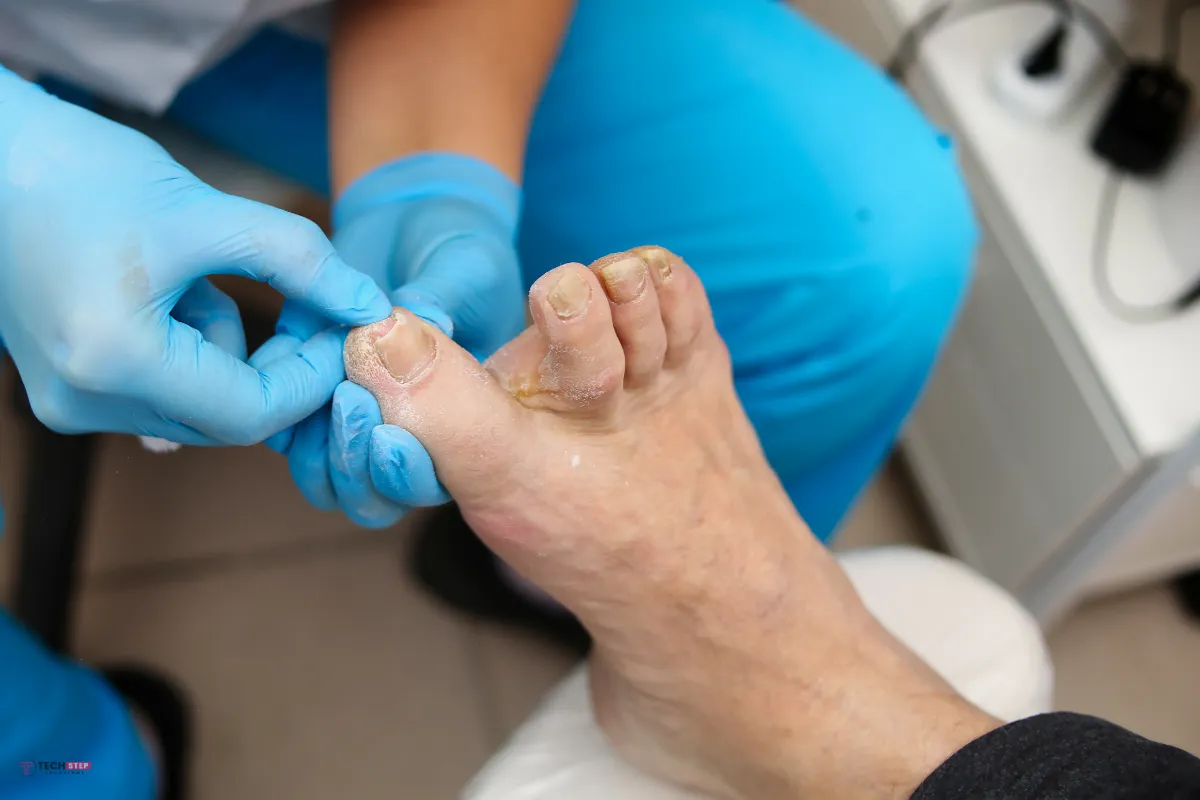 Healthy Toenails Treatment