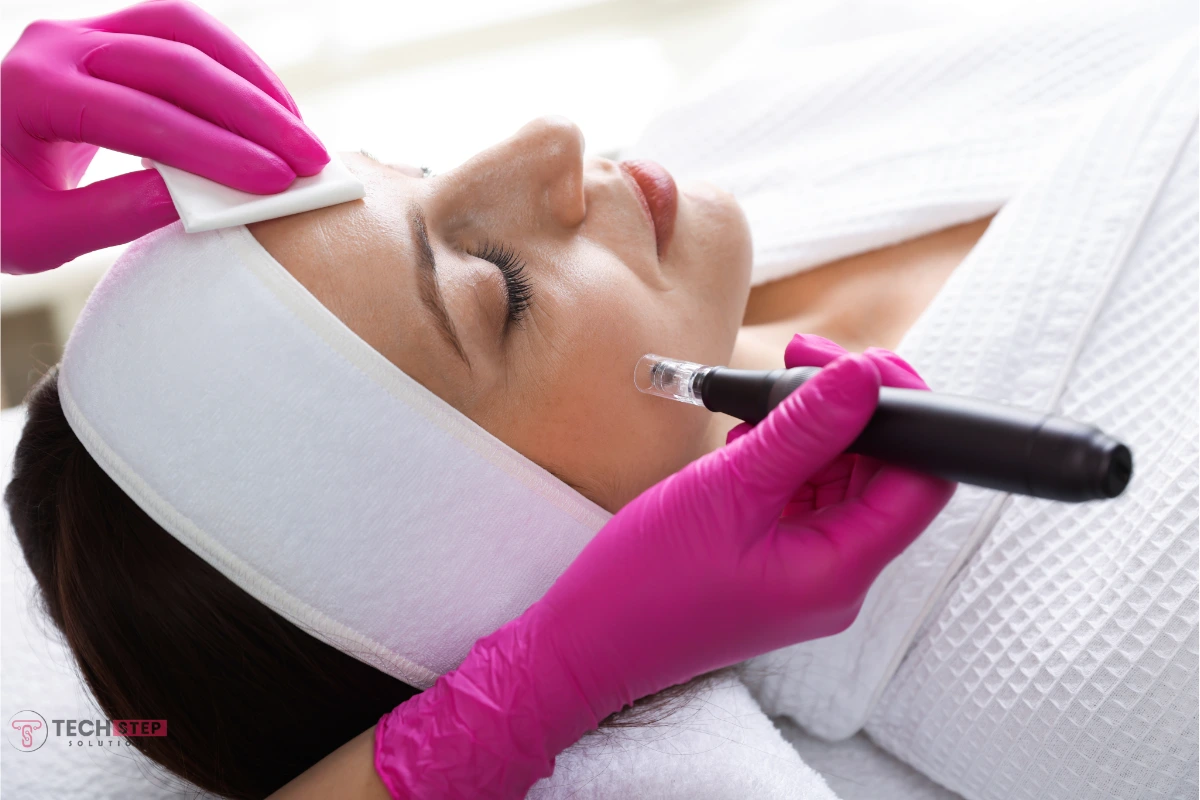 Microneedling Benefits