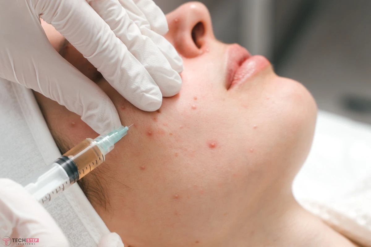 acne redness treatment