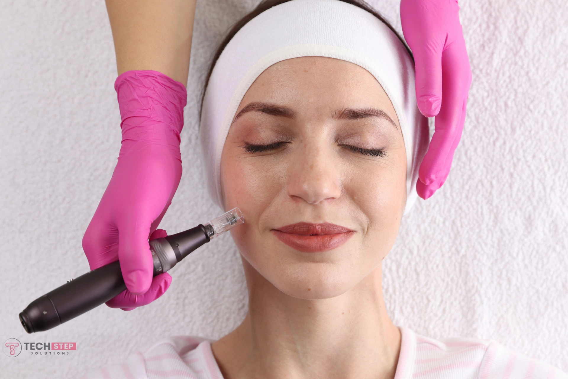 Microneedling Houston