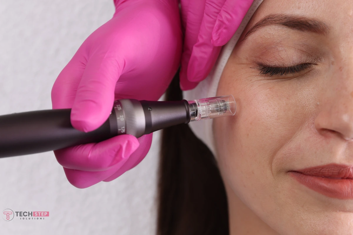 Microneedling Houston TX